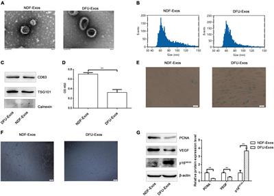 Circulating Exosomal miR-181b-5p Promoted Cell Senescence and Inhibited Angiogenesis to Impair Diabetic Foot Ulcer via the Nuclear Factor Erythroid 2-Related Factor 2/Heme Oxygenase-1 Pathway